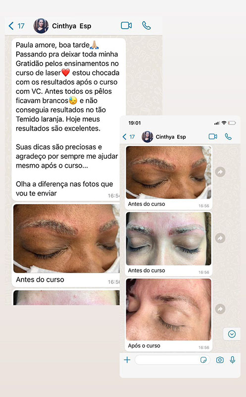 Depoimento Laser Effect (3)
