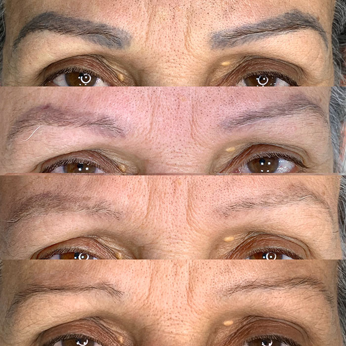 photo-output