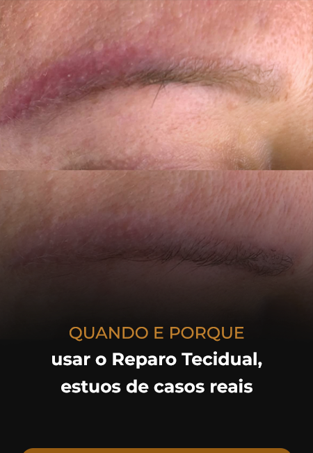 06 novo