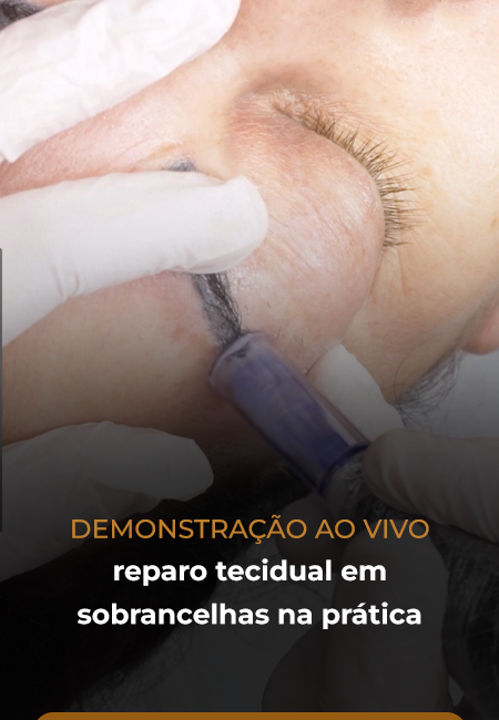 08 novo