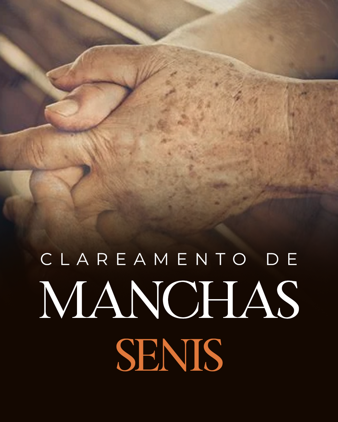 Manchas Senis